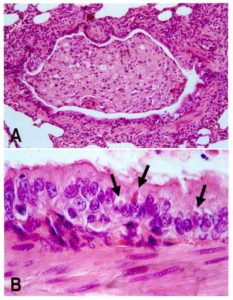 Staupe Virus unter dem Mikroskop